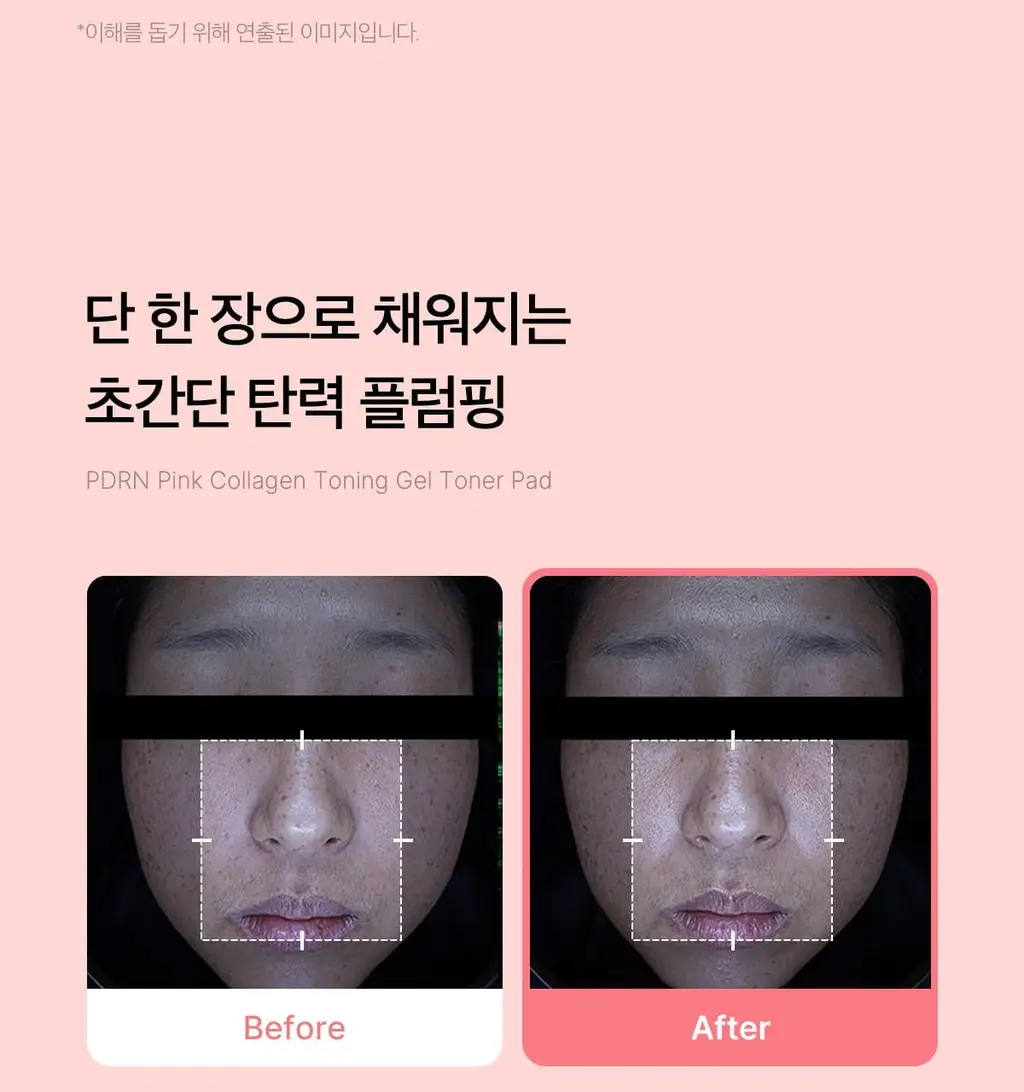[쿨링광채]메디큐브 PDRN 핑크 콜라겐 토닝 겔 토너패드 70매 기획(본품70매+겔패드10매) 상세페이지 62